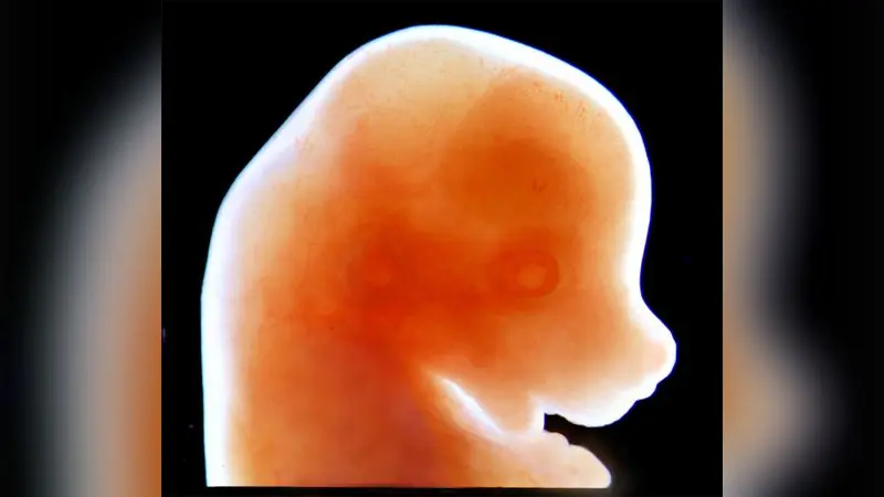 Craniofacial mouse embryo